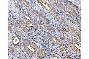 IHC analysis of ALDH1A1 using anti-ALDH1A1 antibody (ABIN7602128).