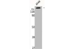 Western Blot analysis of A549 cells using GTBP Polyclonal Antibody (MSH6 antibody  (Internal Region))