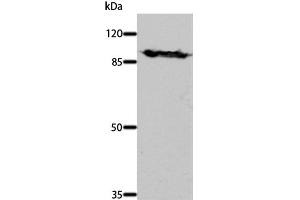 Western Blot analysis of Mouse brain tissue using DNM1 Polyclonal Antibody at dilution of 1:700 (Dynamin 1 antibody)