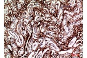 Immunohistochemistry (IHC) analysis of paraffin-embedded Human Kidney, antibody was diluted at 1:100. (M-CSF/CSF1 antibody  (Internal Region))