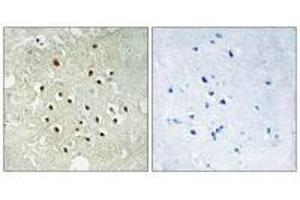 Immunohistochemistry analysis of paraffin-embedded human brain tissue using RPS19BP1 antibody. (RPS19BP1 antibody)