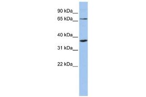 WB Suggested Anti-ZNF274 Antibody Titration:  0. (ZNF274 antibody  (Middle Region))
