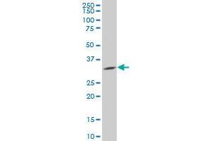 PPM1M polyclonal antibody (A01), Lot # 060626JCS1 Western Blot analysis of PPM1M expression in Jurkat . (PPM1M antibody  (AA 102-192))