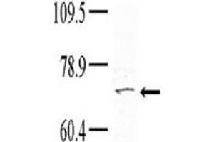 Image no. 1 for anti-Tyrosine Kinase, Non-Receptor, 1 (TNK1) (Middle Region) antibody (ABIN359998) (TNK1 antibody  (Middle Region))