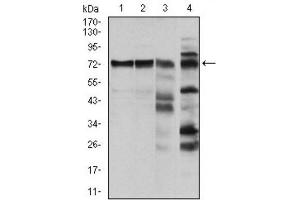 Western Blotting (WB) image for anti-V-Raf-1 Murine Leukemia Viral Oncogene Homolog 1 (RAF1) antibody (ABIN1844891)