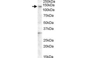 GPR125 polyclonal antibody  (0. (GPR125 antibody)