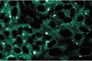 Immunofluorescence staining on human endothelial cells. (MAP2K5 antibody  (AA 13-188))
