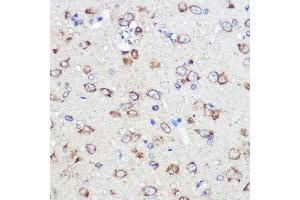 Immunohistochemistry (IHC) image for anti-Leucine Rich Repeat Containing 59 (LRRC59) (AA 1-244) antibody (ABIN6143345)