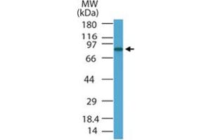 Western blot analysis of PRDM5 in HL-60 cell lysate using PRDM5 polyclonal antibody  at 1 ug/mL . (PRDM5 antibody  (AA 100-200))
