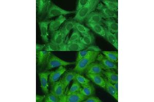 Immunofluorescence (IF) image for anti-Nuclear Factor-kB p65 (NFkBP65) (AA 50-180) antibody (ABIN3016235)