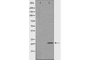 Western blot analysis of stomach  lysate using CSRP1 antibody. (CSRP1 antibody  (Internal Region))