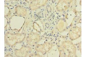 Immunohistochemistry of paraffin-embedded human kidney tissue using ABIN7150898 at dilution of 1:100 (TCTE1 antibody  (AA 285-501))