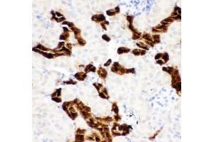 Immunohistochemistry (IHC) image for anti-Calbindin (CALB1) (AA 2-175) antibody (ABIN3030248)