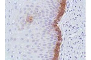 Anti-BAX monoclonal antibody-Immunohistochemistry  anti-BAX monoclonal antibody (Rabbit) was used to detect BAX in Human Cervix tissue.