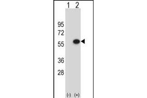 Western blot analysis of ERGIC3 (arrow) using rabbit polyclonal ERGIC3 Antibody (N-term) (ABIN653165 and ABIN2842731). (ERGIC3 antibody  (N-Term))