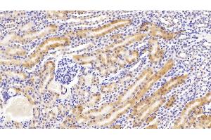 Detection of PCK1 in Mouse Kidney Tissue using Polyclonal Antibody to Phosphoenolpyruvate Carboxykinase 1, Soluble (PCK1)