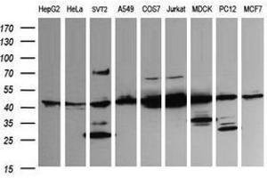 Image no. 2 for anti-Mitogen-Activated Protein Kinase Kinase 1 (MAP2K1) antibody (ABIN1499383) (MEK1 antibody)