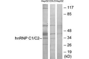 Western blot analysis of extracts from HepG2/COLO205 cells, using hnRNP C1/C2 Antibody. (HNRNPC antibody  (AA 241-290))