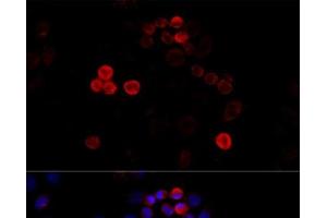 Immunofluorescence analysis of HeLa cells using FLNA Polyclonal Antibody at dilution of 1:100 (40x lens).