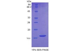 SDS-PAGE (SDS) image for Growth Differentiation Factor 6 (GDF6) (AA 339-454) protein (His tag) (ABIN1878304) (GDF6 Protein (AA 339-454) (His tag))