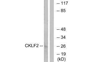 Western blot analysis of extracts from K562 cells, using CKLF2 antibody. (CKLF antibody  (C-Term))
