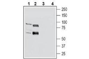 Western blot analysis of mouse kidney lysates (lanes 1 and 3) and rat small intestine lysates (lanes 2 and 4): - 1-2. (SLC22A4 antibody  (Intracellular))
