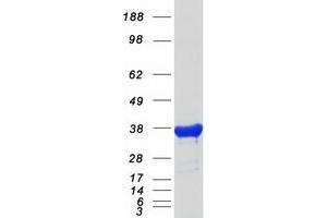 Validation with Western Blot (GPD1 Protein (Myc-DYKDDDDK Tag))