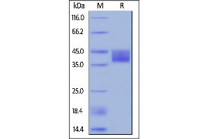 SDS-PAGE (SDS) image for Mesothelin (MSLN) (AA 296-580) protein (His tag,FITC) (ABIN5954923)