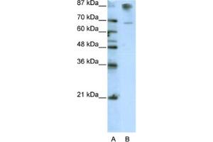 Western Blotting (WB) image for anti-HKR1, GLI-Kruppel Zinc Finger Family Member (HKR1) antibody (ABIN2462014) (HKR1 antibody)