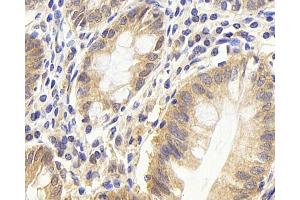 Immunohistochemistry analysis of paraffin-embedded human colon using CDC25A Polyclonal Antibody at dilution of 1:1000. (CDC25A antibody)