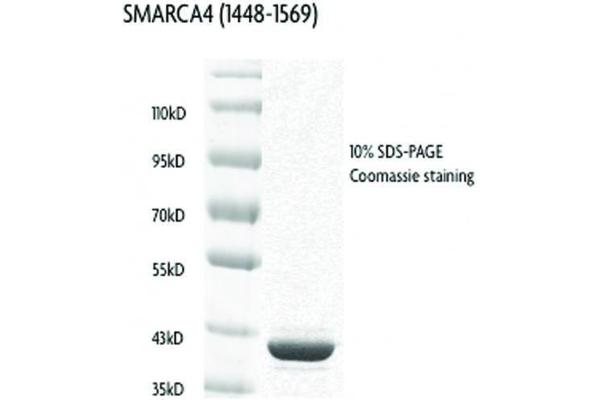 SMARCA4 Protein (AA 1448-1569) (GST tag)