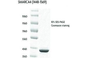 Recombinant SMARCA4 / BRG1 (1448-1569), GST-tag protein gel.