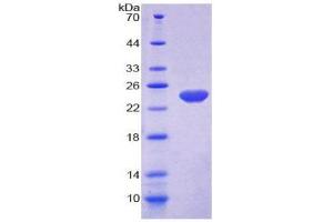SDS-PAGE (SDS) image for Nitric Oxide Synthase 3 (Endothelial Cell) (NOS3) (AA 522-705) protein (His tag) (ABIN2126095)