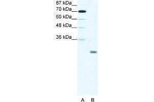 WB Suggested Anti-ID4 Antibody Titration:  1. (ID4 antibody  (N-Term))