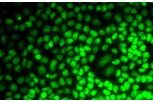 Immunofluorescence analysis of MCF7 cells using CCNE2 Polyclonal Antibody (Cyclin E2 antibody)