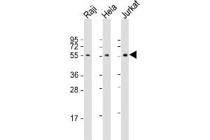 All lanes : Anti-IRF3 Antibody (N-Term) at 1:2000 dilution Lane 1: Raji whole cell lysate Lane 2: Hela whole cell lysate Lane 3: Jurkat whole cell lysate Lysates/proteins at 20 μg per lane. (IRF3 antibody  (AA 78-108))
