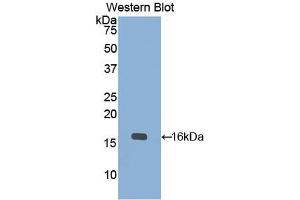 Western blot analysis of the recombinant protein. (KRT15 antibody  (AA 274-399))
