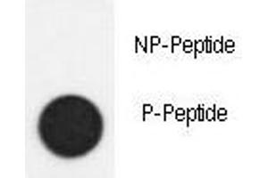 Dot blot analysis of phospho-SMAD2 antibody. (SMAD2 antibody  (pSer118))