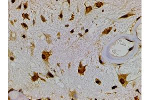 Immunohistochemistry (IHC) image for anti-Ephrin B2 (EFNB2) (C-Term) antibody (ABIN6261455)