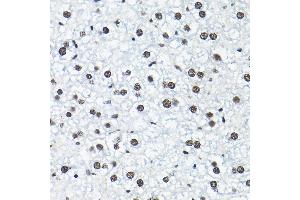 Immunohistochemistry of paraffin-embedded mouse liver using SNRP Rabbit pAb (2161) at dilution of 1:200 (40x lens). (SNRPA1 antibody  (AA 1-220))
