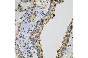 Immunohistochemistry of paraffin-embedded mouse lung using DNM2 antibody.