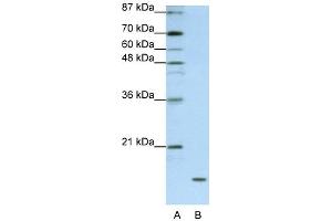 WB Suggested Anti-FAM121B Antibody Titration:  1. (APOO antibody  (C-Term))