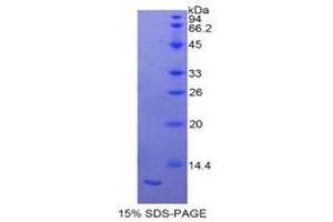 SDS-PAGE (SDS) image for S100 Calcium Binding Protein A11 (S100A11) (AA 9-98) protein (His tag) (ABIN2122035)