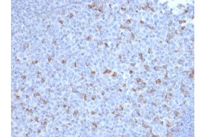 Formalin-fixed, paraffin-embedded human Tonsil stained with PD1 (CD279) Mouse Monoclonal Antibody (PDCD1/2720). (PD-1 antibody)