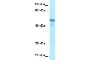 WB Suggested Anti-Ccdc6 Antibody Titration: 1. (CCDC6 antibody  (N-Term))