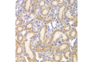 Immunohistochemistry of paraffin-embedded rat kidney using EYA3 antibody. (EYA3 antibody  (AA 1-300))