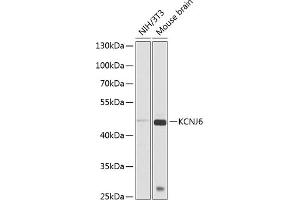 Western blot analysis of extracts of various cell lines, using KCNJ6 antibody (ABIN6129433, ABIN6142742, ABIN6142743 and ABIN6225263) at 1:1000 dilution. (KCNJ6 antibody  (AA 1-80))
