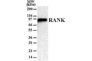 Western Blotting (WB) image for anti-Tumor Necrosis Factor Receptor Superfamily, Member 11a, NFKB Activator (TNFRSF11A) antibody (ABIN6655792)