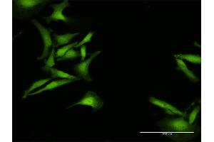 Immunofluorescence of purified MaxPab antibody to C1orf38 on HeLa cell. (C1orf38 antibody  (AA 1-132))
