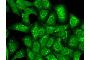 Immunocytochemistry/Immunofluorescence analysis using Mouse Anti-Slo2. (KCNT1 antibody  (AA 1168-1237) (Atto 594))